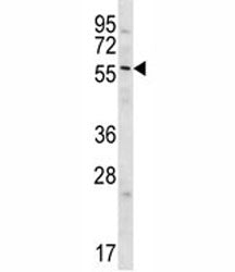GPC3 Antibody