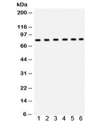 Western blot testing of rat 1) pancreas, 2) lung, 3) intestine, and human 4) SW620, 5) COLO320 and 6