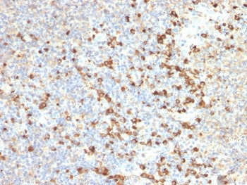 TIM-3 Antibody / HAVCR2