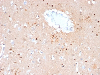IHC staining of FFPE human brain with Ubiquitin antibody (clone UBB/2122). Required HIER: boil tissu