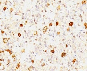 FSH beta Antibody