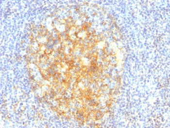 IHC: Formalin-fixed, paraffin-embedded human tonsil stained with VCAM1 antibody (VCAM1/843).