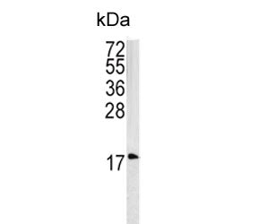 Caveolin-3 Antibody / CAV3