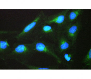 SPTLC1 Antibody