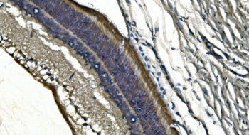 IHC staining of FFPE rat retina with PDE6 alpha antibody. HIER: boil tissue sections in pH8 EDTA for