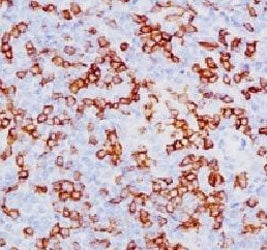 CD8A Antibody