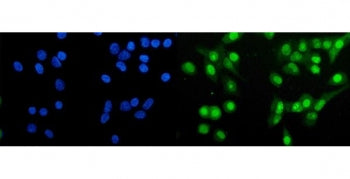 Immunofluorescent staining of FFPE human A549 cells with Huntingtin-associated protein 1 antibody (g