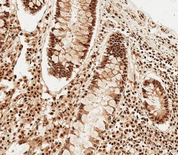 IHC testing of FFPE human colon tissue with SNRPD3 antibody. HIER: steam section in pH6 citrate buff