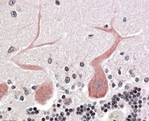 CDC42BPA Antibody
