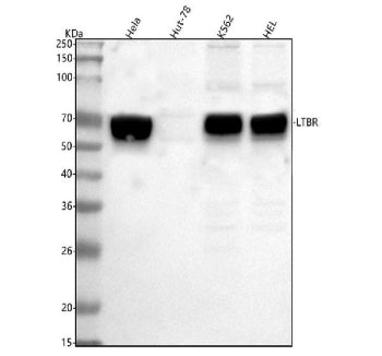 Western blot analysis of LTBR using anti-LTBR antibody. Lane 1: human Hela whole cell lysates, Lane 
