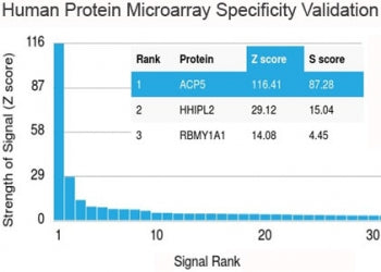 Analysis of HuProt(TM) microarray containing more than 19,000 full-length human proteins using recom