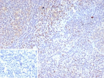 IHC staining of FFPE human tonsil tissue with recombinant LEF1 antibody (clone LEF1/9403R). Strong n