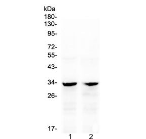 Western blot testing of 1) rat kidney and 2) mouse kidney with Caspase-6 antibody at 0.5ug/ml. Predi