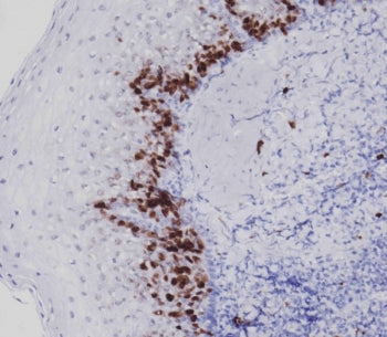 IHC testing of FFPE human tonsil tissue with Ki67 antibody. HIER: steam section in pH9 EDTA for 20 m