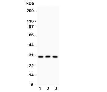 Western blot testing of HOXA9 antibody and Lane 1: rat testis; 2: human HEPG2; 3: mouse HEPA lysate.