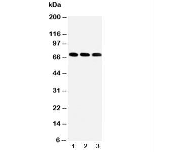IRAK-M Antibody