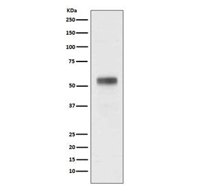 Western blot testing of human MCF-7 cell lysate with RARA antibody. Predicted molecular weight ~51 k