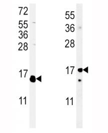 (Left) Western blot analysis of IL-4 antibody and WiDr lysate; (Right) Western blot analysis of IL-4