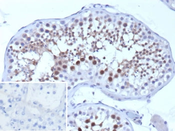 IHC staining of FFPE human testis tissue with SMN1 antibody (clone SMN1/1596). Inset: PBS used in pl