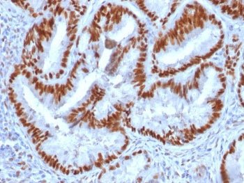 Estrogen Receptor alpha Antibody