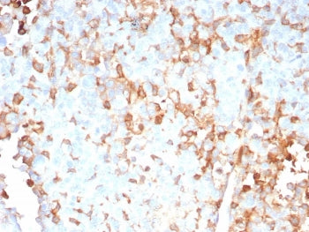 IHC staining of FFPE human adrenal gland tissue with IL-2 antibody (clone IL2/9007). HIER: boil tiss