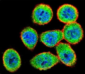 IKK beta Antibody