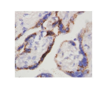 IHC-P: beta-HCG antibody testing of human placenta tissue. HIER: steamed with pH6 citrate buffer, HR