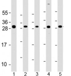 ARD1A Antibody / NAA10