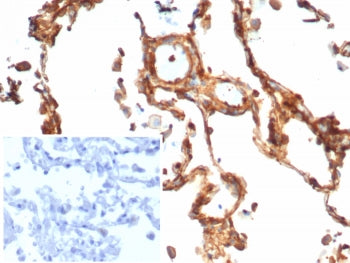 Vinculin Antibody