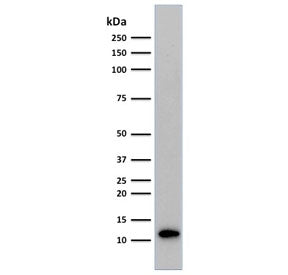Beta-2 Microglobulin Antibody