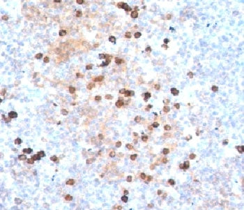 IgM Heavy Chain Antibody