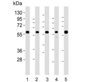 Western blot testing of 1) human Jurkat, 2) human brain, 3) mouse brain, 4) mouse lung and 5) rat br