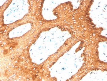 IHC staining of FFPE human skin with recombinant Type II Cytokeratin antibody (clone KRTH/4392R). HI
