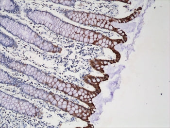 Cytokeratin 20 Antibody / CK20