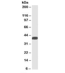 Western blot testing of human heart lysate with ALS2CR1 antibody at 1ug/ml. Predicted/observed molec
