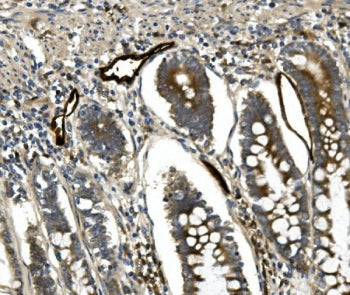 MADCAM1 Antibody