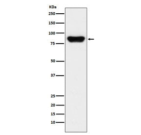 Western blot testing with Prothrombin antibody. Predicted molecular weight ~70 kDa but may be observ