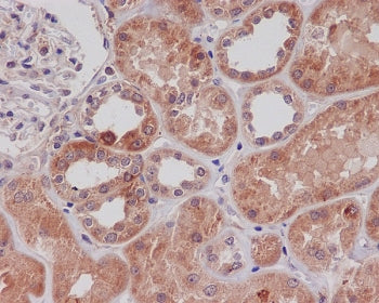 IHC staining of FFPE human kidney tissue with TLR2 antibody. HIER: boil tissue sections in pH6, 10mM