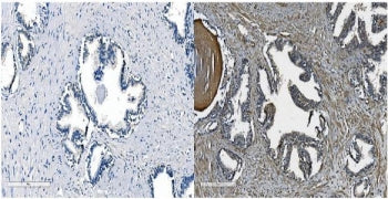 Cadherin 11 Antibody / CDH11