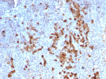 IHC testing of FFPE human tonsil tissue with recombinant anti-Kappa light chain antibody (clone rKLC