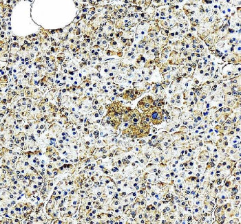 Immunohistochemical staining of EIF2A using anti-EIF2A antibody. EIF2A was detected in a paraffin-em