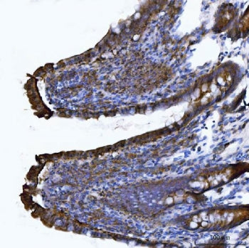 Integrin alpha E Antibody / Cd103