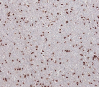 IHC testing of FFPE human brain tissue with Single-minded homolog 1 antibody. HIER: steam section in