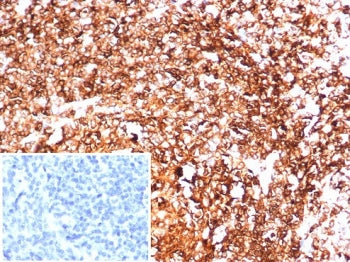 IHC staining of FFPE human tonsil tissue with HLA-DR antibody (clone HLA-DRA/6844R). Inset: PBS used