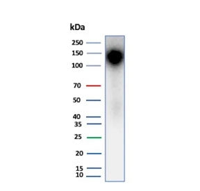 Western blot testing of human kidney tissue lysate using recombinant Ksp-Cadherin antibody (clone rC