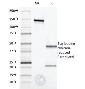 Interferon alpha 1 Antibody / IFNA1