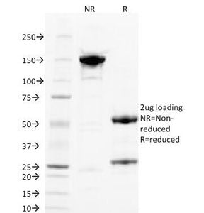 PLGF Antibody / PGF / Placenta Growth Factor