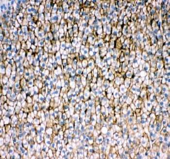 IHC staining of FFPE rat adrenal gland tissue with Srb1 antibody. HIER: boil tissue sections in pH8 