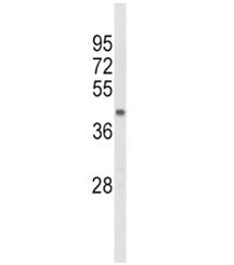 ACADL Antibody
