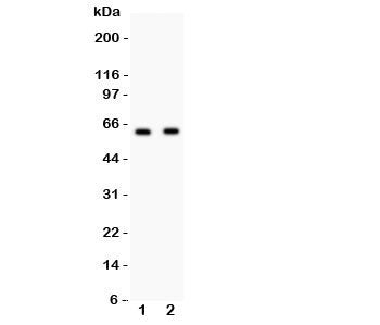 HEXB Antibody